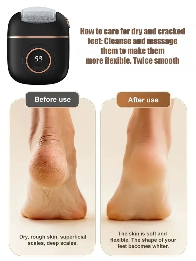 🌷2025 Spring Hot Sale 56% OFF🌸 New digital electric foot polishing machine