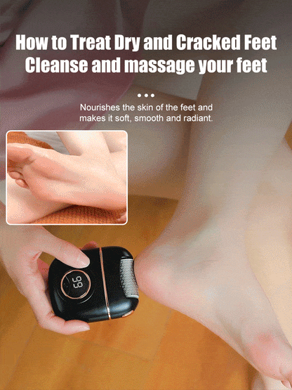 🌷2025 Spring Hot Sale 56% OFF🌸 New digital electric foot polishing machine