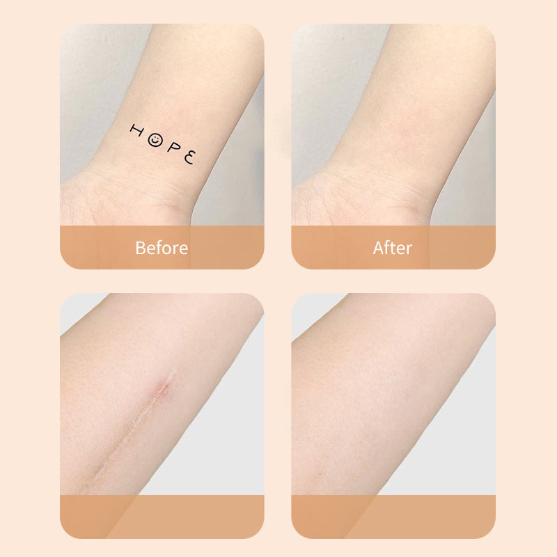 🔥Buy 1 Get 1 Free 🔥2024 New Products Ultra-Thin Tattoo and Scar Concealer Patch