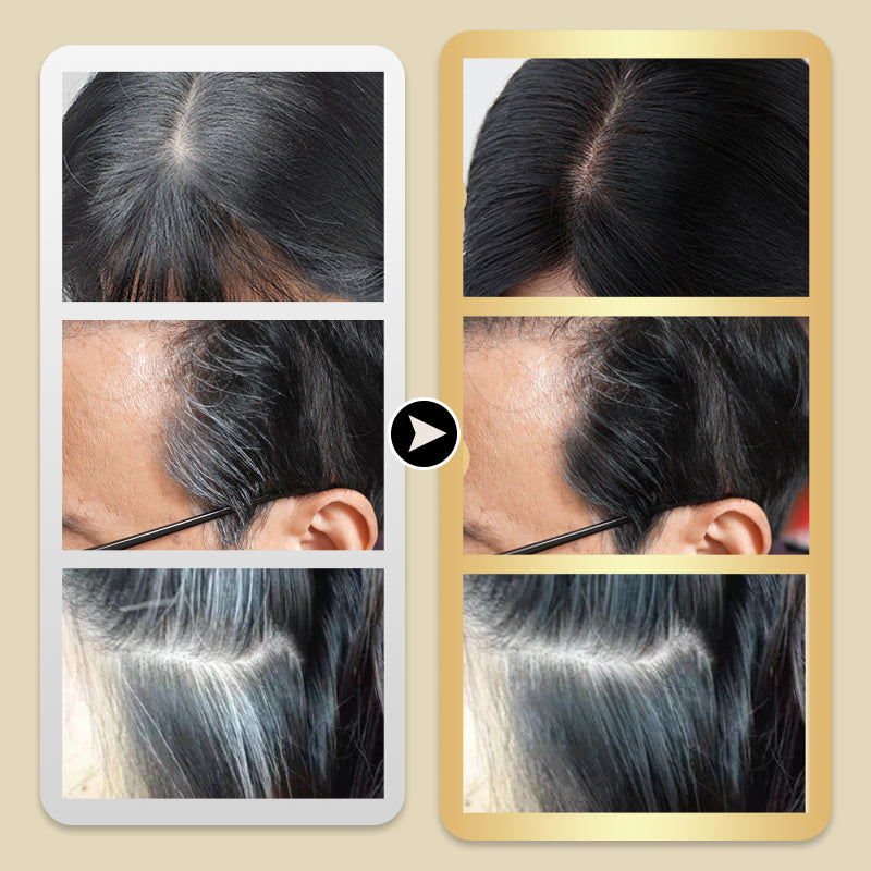 💆‍♀️🎨Safe and Convenient Comb Hair Dye🔐 Effortless Coloring, Hair Care, Beautiful with Peace of Mind!