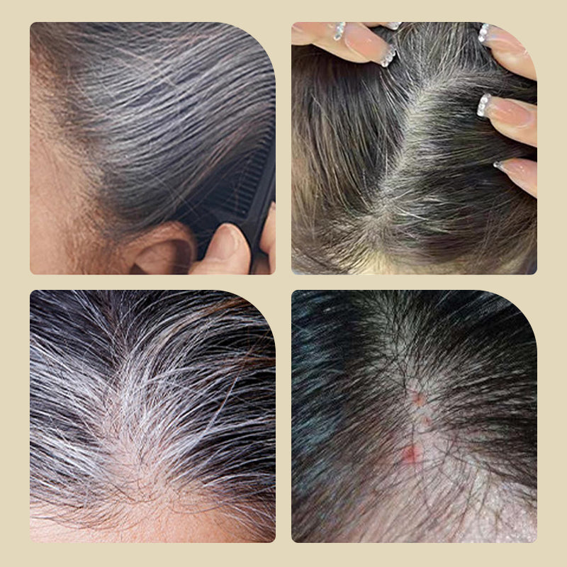 💆‍♀️🎨Safe and Convenient Comb Hair Dye🔐 Effortless Coloring, Hair Care, Beautiful with Peace of Mind!