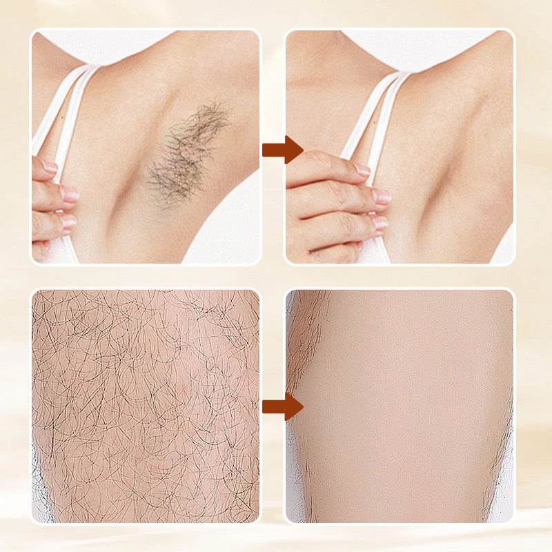 💥Buy 2 Get 1 Free🔥Versatile, Aromatic, Mild Formula Hair Removal Cream