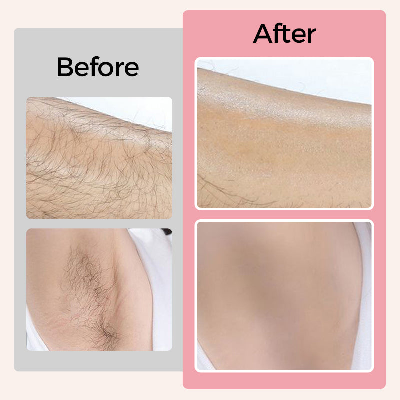 Cleansing & Softening Hair Removal Cream Set