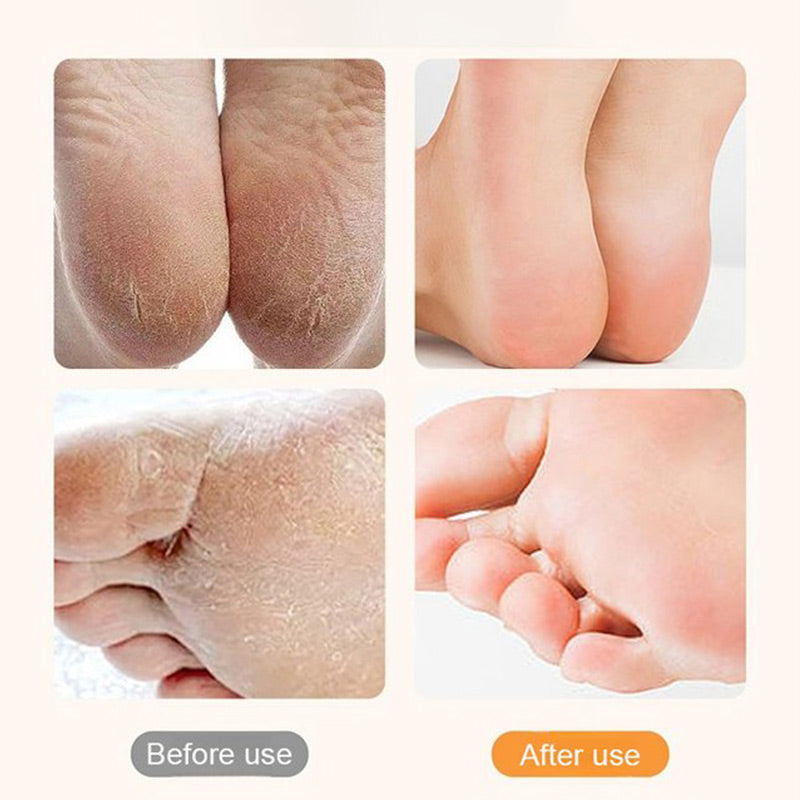 🔋🦶Rechargeable Electric Foot Exfoliating Scrubber🌟 Gently Exfoliates, Smooths Feet, Essential for Home Pedicures!