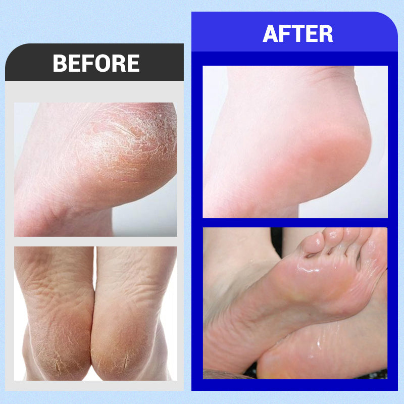 📣The Summer Hot Sale(Buy 3 Get 1 Free) 🫧 Scented Antibacterial Deodorizing Foot Wash Liquid