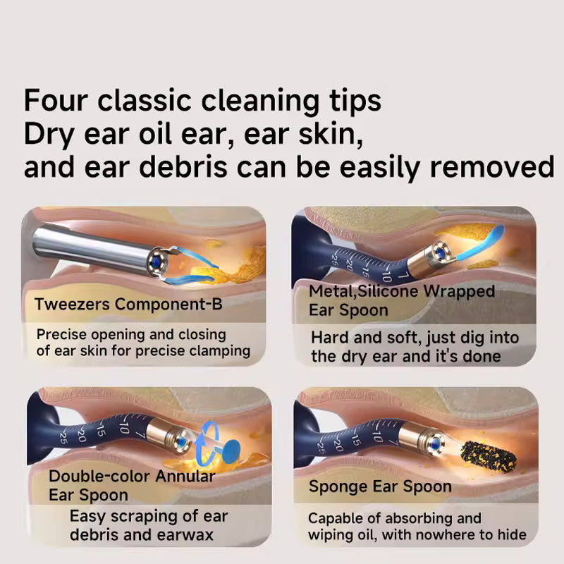 🎉🛍️Mother's Day Limited Time 55% OFF😍 👂Visual Arc Ear Wax Removal Kit