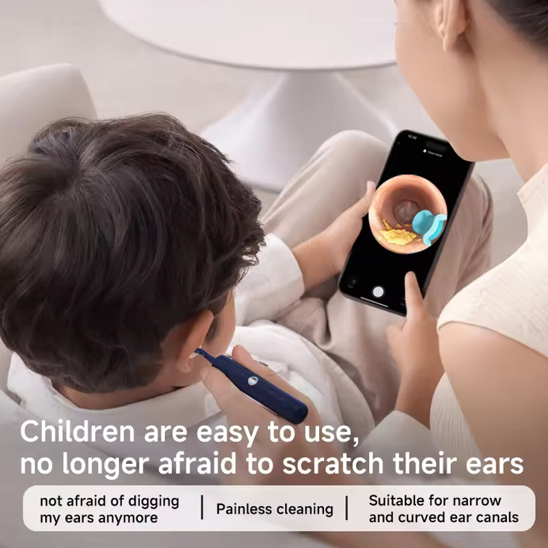 🎉🛍️Mother's Day Limited Time 55% OFF😍 👂Visual Arc Ear Wax Removal Kit