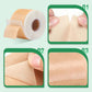 Reusable Silicone Scar Sheets for Surgical Scars