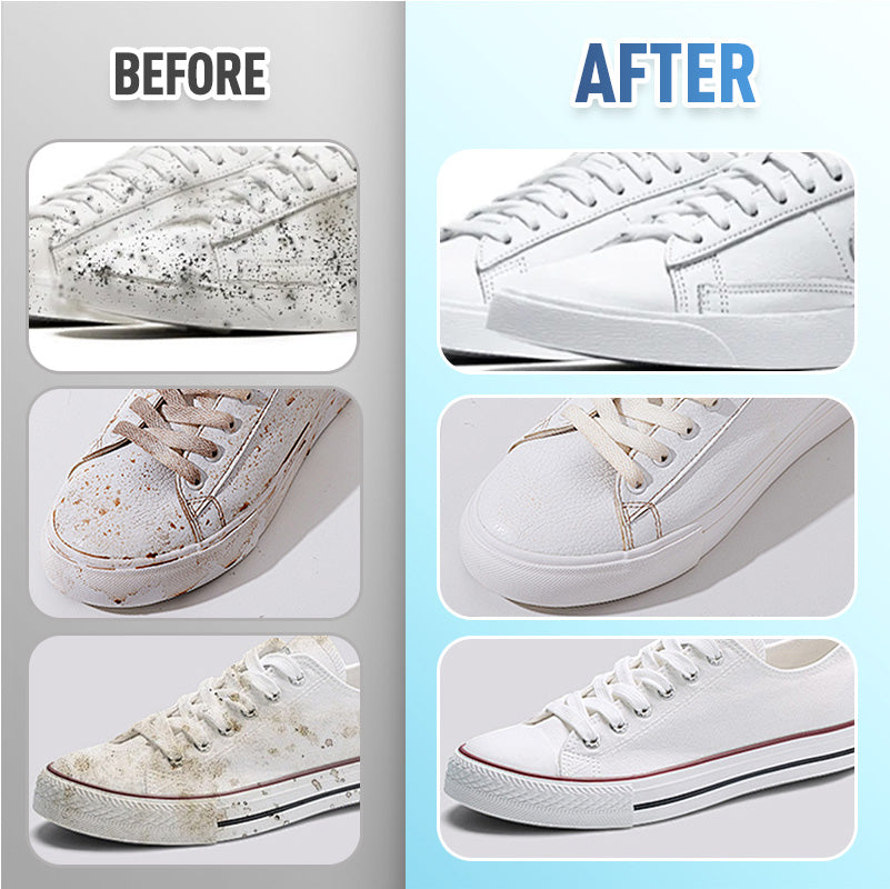 👟✨Hot Sale 50% OFF🔥Quick-Clean Shoe Wipes